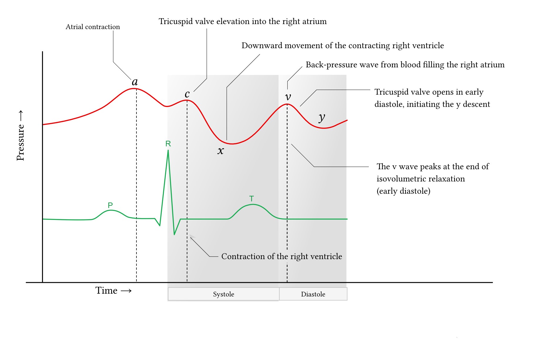 CVP waveform with labels